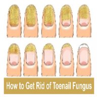 GetRidofToenailFungus